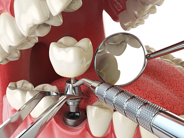 Best Emergency Orthodontic Repairs in Corinth, TX